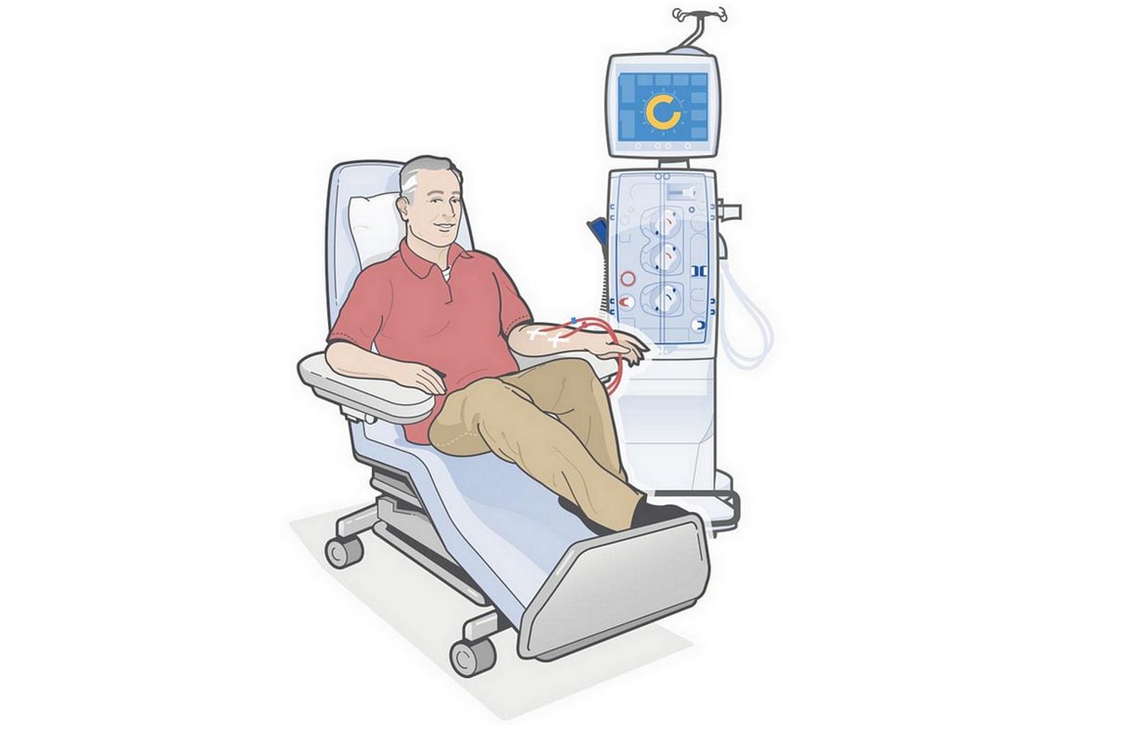 Patient receiving hemodialysis treatment