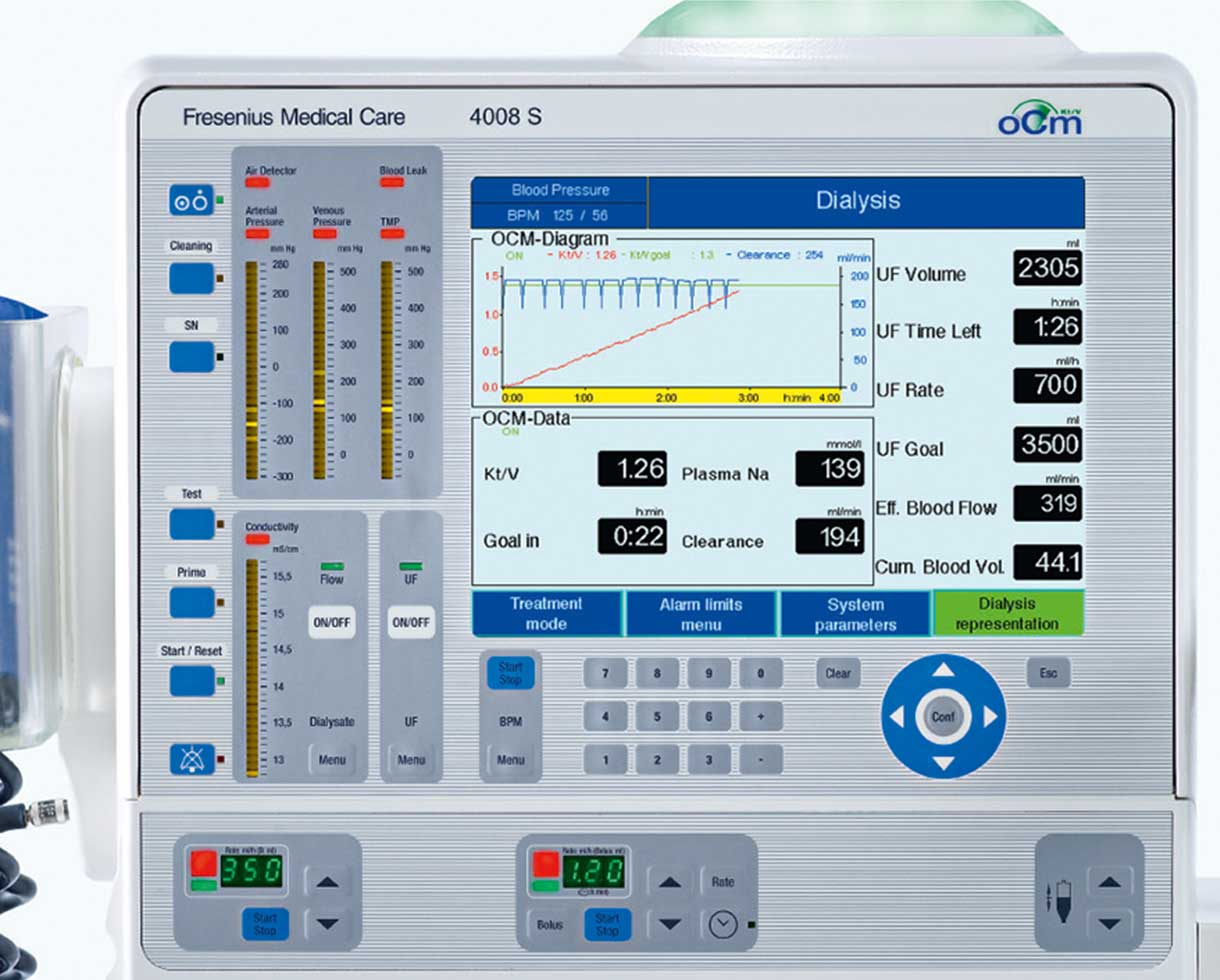 Online Clearance Monitor (OCM ®) settings