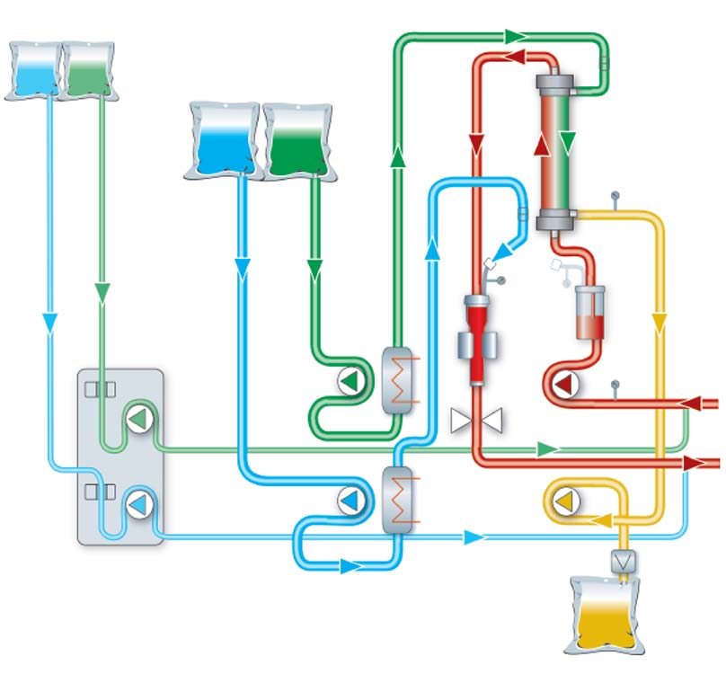 Ci-Ca® post-CVVHDF schema