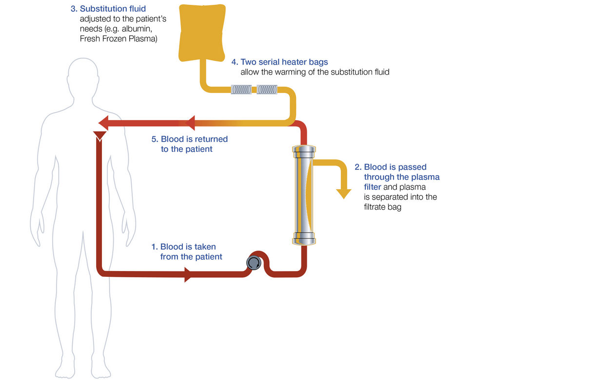 Therapeutic Plasma Exchange