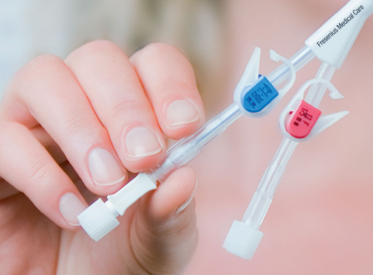 Person holding double lumen catheter Person holding double lumen catheter