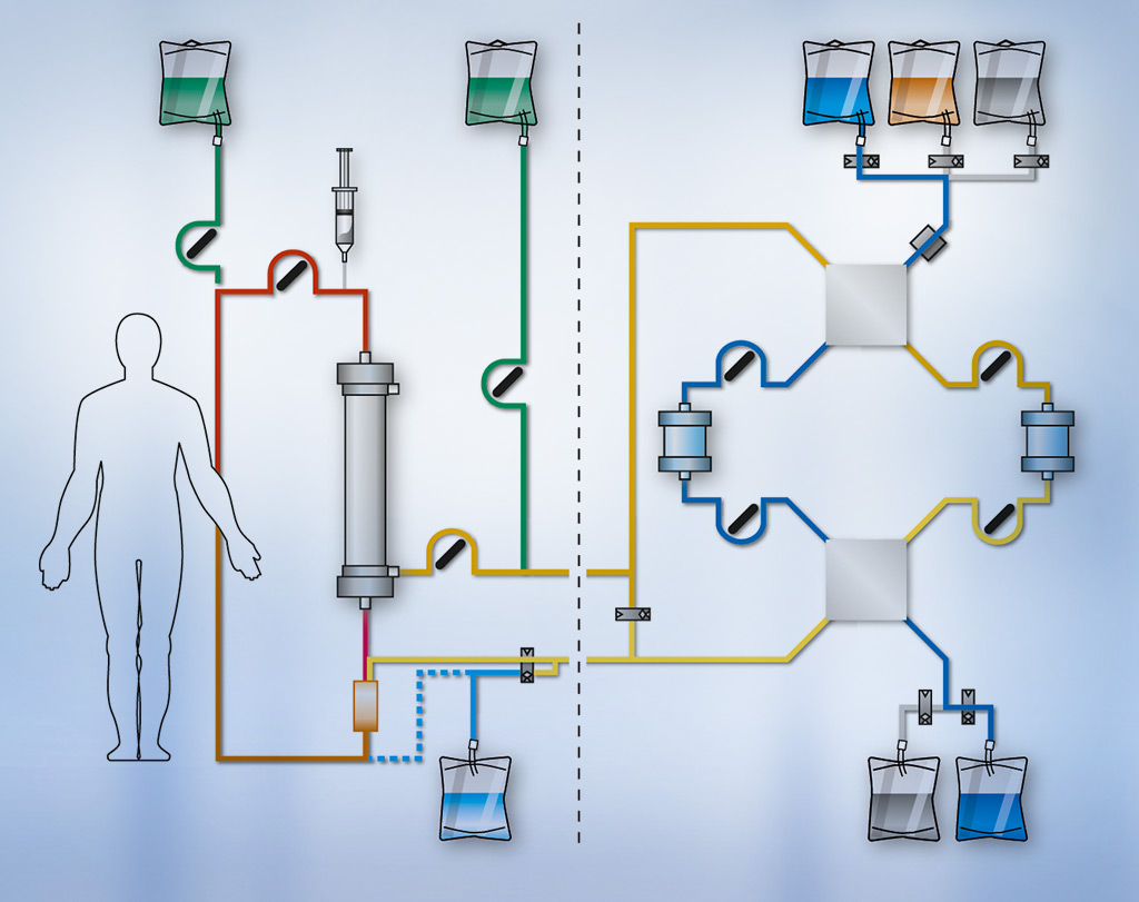 Immune apheresis with twin adsorbers