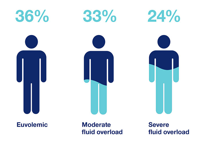 study of PD with fluid management