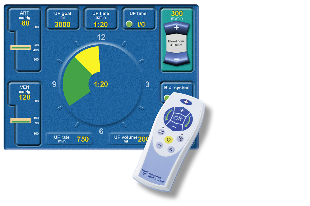 screen remote