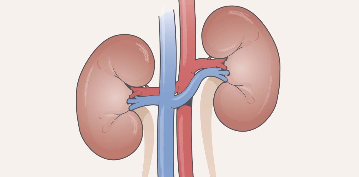 Kidney disease